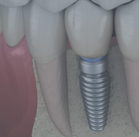 treatments-thumb